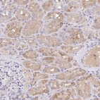 Immunohistochemical staining of human kidney shows moderate cytoplasmic positivity in cells in tubules.