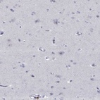Immunohistochemical staining of human cerebral cortex shows low expression as expected.