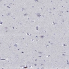 Immunohistochemical staining of human cerebral cortex shows low expression as expected.