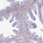 Immunohistochemical staining of human prostate shows moderate cytoplasmic positivity in smooth muscle cells.