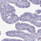 Immunohistochemical staining of human fallopian tube shows no positivity in glandular cells as expected.