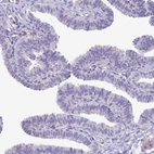 Immunohistochemical staining of human fallopian tube shows no positivity in glandular cells as expected.