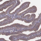 Anti-PDCD2L Antibody