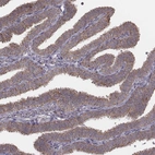 Anti-PDCD2L Antibody