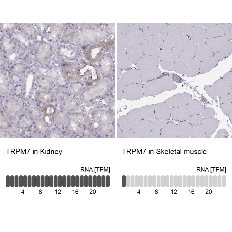 Anti-TRPM7 Antibody