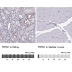 Anti-TRPM7 Antibody
