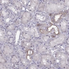 Immunohistochemical staining of human kidney shows strong membranous-cytoplasmic positivity in cells in tubules.