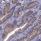 Immunohistochemical staining of human small intestine shows strong cytoplasmic-membranous positivity in enteroendocrine cells and moderate positivity in goblet cells.