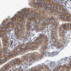 Immunohistochemical staining of human fallopian tube shows strong cytoplasmic positivity in glandular cells.
