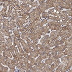 Immunohistochemical staining of human liver shows strong cytoplasmic positivity in hepatocytes.