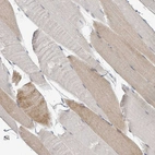 Immunohistochemical staining of human skeletal muscle shows weak cytoplasmic positivity in myocytes.