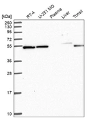 Western blot analysis in human cell line RT-4, human cell line U-251 MG, human plasma, human liver tissue and human tonsil tissue.