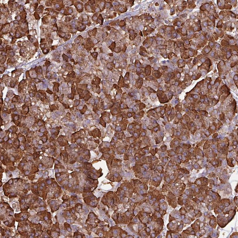 Anti-WBSCR22 Antibody