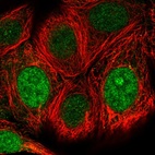 Immunofluorescent staining of human cell line MCF7 shows localization to nucleus & nucleoli.