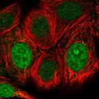 Immunofluorescent staining of human cell line MCF7 shows localization to nucleus & nucleoli.
