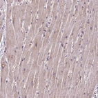 Immunohistochemical staining of human heart muscle shows moderate cytoplasmic positivity in cardiomyocytes.