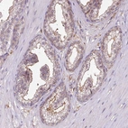 Immunohistochemical staining of human prostate shows weak cytoplasmic and membranous positivity in glandular cells.