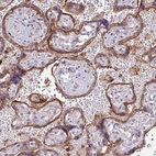 Immunohistochemical staining of human placenta shows strong cytoplasmic and membranous positivity in trophoblastic cells.