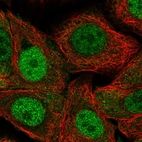 Immunofluorescent staining of human cell line MCF7 shows localization to nucleoplasm & cytosol.