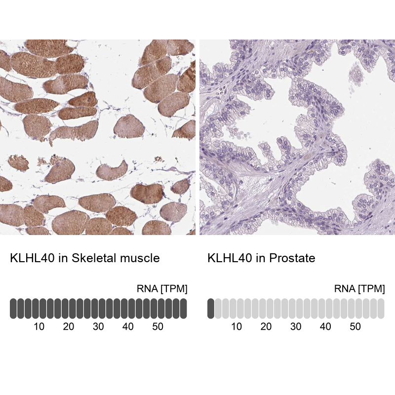 Anti-KLHL40 Antibody