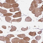 Immunohistochemical staining of human skeletal muscle shows high expression.