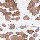 Immunohistochemical staining of human skeletal muscle shows high expression.