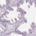 Immunohistochemical staining of human prostate shows low expression as expected.