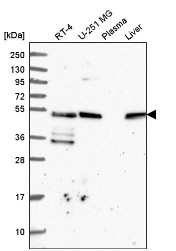 Anti-TFG Antibody