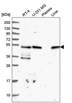 Anti-TFG Antibody