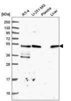 Anti-TFG Antibody