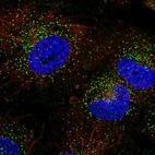 Immunofluorescent staining of human cell line U-251 MG shows localization to vesicles.