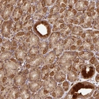 Anti-MALSU1 Antibody