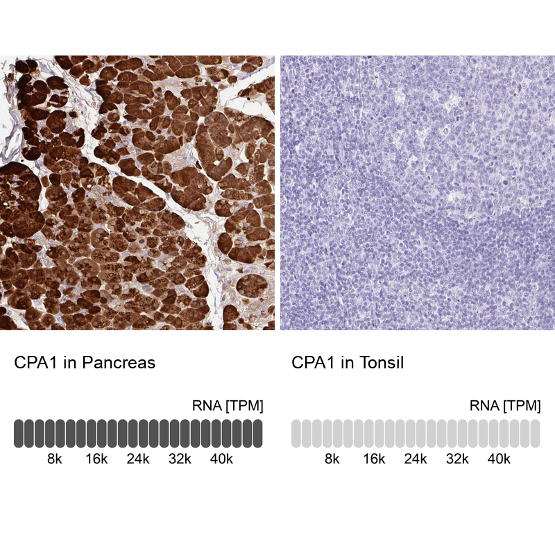 Anti-CPA1 Antibody