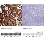 Anti-CPA1 Antibody