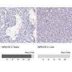 Anti-QRICH2 Antibody