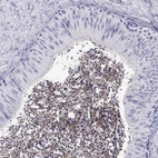 Immunohistochemical staining of human epididymis shows strong positivity in sperm flagella.