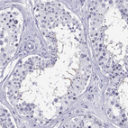 Immunohistochemical staining of human testis shows strong positivity in sperm flagella.