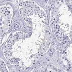 Immunohistochemical staining of human testis shows strong positivity in sperm flagella.