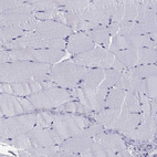 Immunohistochemical staining of human skeletal muscle shows no positivity in myocytes as expected.
