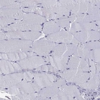 Immunohistochemical staining of human skeletal muscle shows no positivity in myocytes as expected.