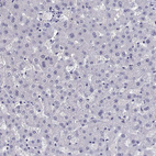 Immunohistochemical staining of human liver shows no positivity in hepatocytes as expected.