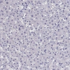Immunohistochemical staining of human liver shows no positivity in hepatocytes as expected.