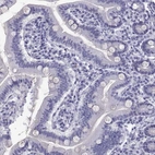 Immunohistochemical staining of human small intestine shows no positivity in glandular cells as expected.