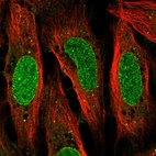 Anti-QRICH2 Antibody