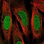 Immunofluorescent staining of human cell line U-2 OS shows localization to nucleoplasm, nuclear membrane & vesicles.