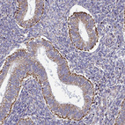 Immunohistochemical staining of human endometrium shows strong granular positivity in cytoplasm in glandular cells.