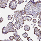 Immunohistochemical staining of human placenta shows moderate granular positivity in cytoplasm in trophoblastic cells.
