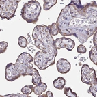 Immunohistochemical staining of human placenta shows moderate granular positivity in cytoplasm in trophoblastic cells.