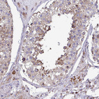 Immunohistochemical staining of human testis shows moderate granular positivity in cytoplasm in cells in seminiferous ducts.
