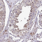 Immunohistochemical staining of human testis shows moderate granular positivity in cytoplasm in cells in seminiferous ducts.